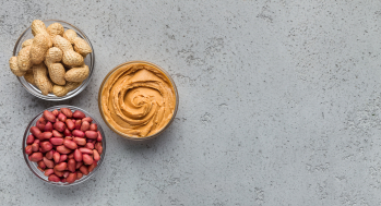 Bowls of peanuts and peanut butter — peanut allergy is the most common cause of food anaphylaxis in children